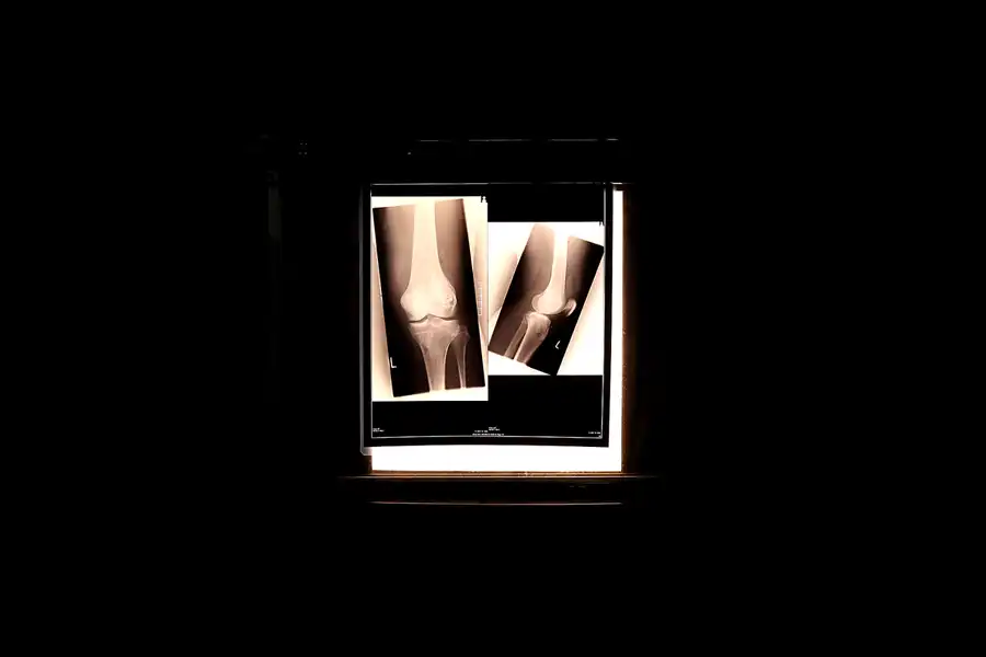 011 | 2022 | Gunzenhausen | Unterirdisches Hilfskrankenhaus | © carsten riede fotografie